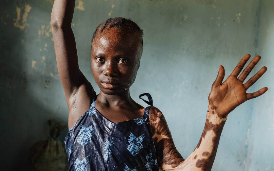 No Longer Held Back: A Turning Point for Jaminatu’s Future